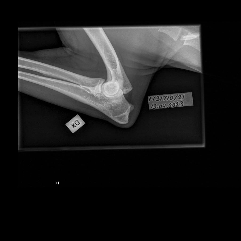 Eturaajat -Kyynärnivel LAT-6.11.2023-16_02_19-577