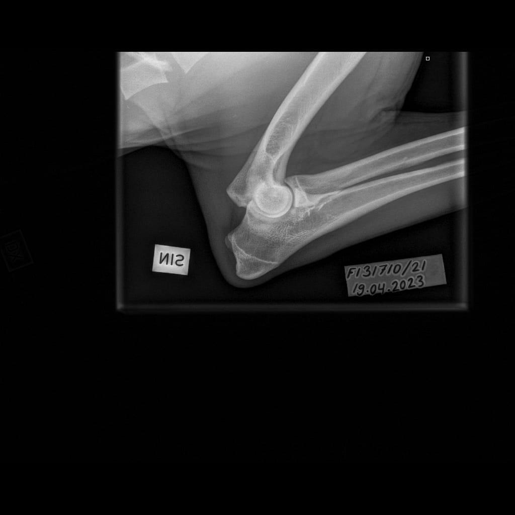 Eturaajat -Kyynärnivel LAT-6.11.2023-16_02_23-281