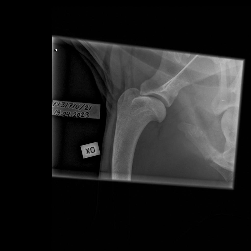 Eturaajat -Olkanivel ML -6.11.2023-16_02_08-264