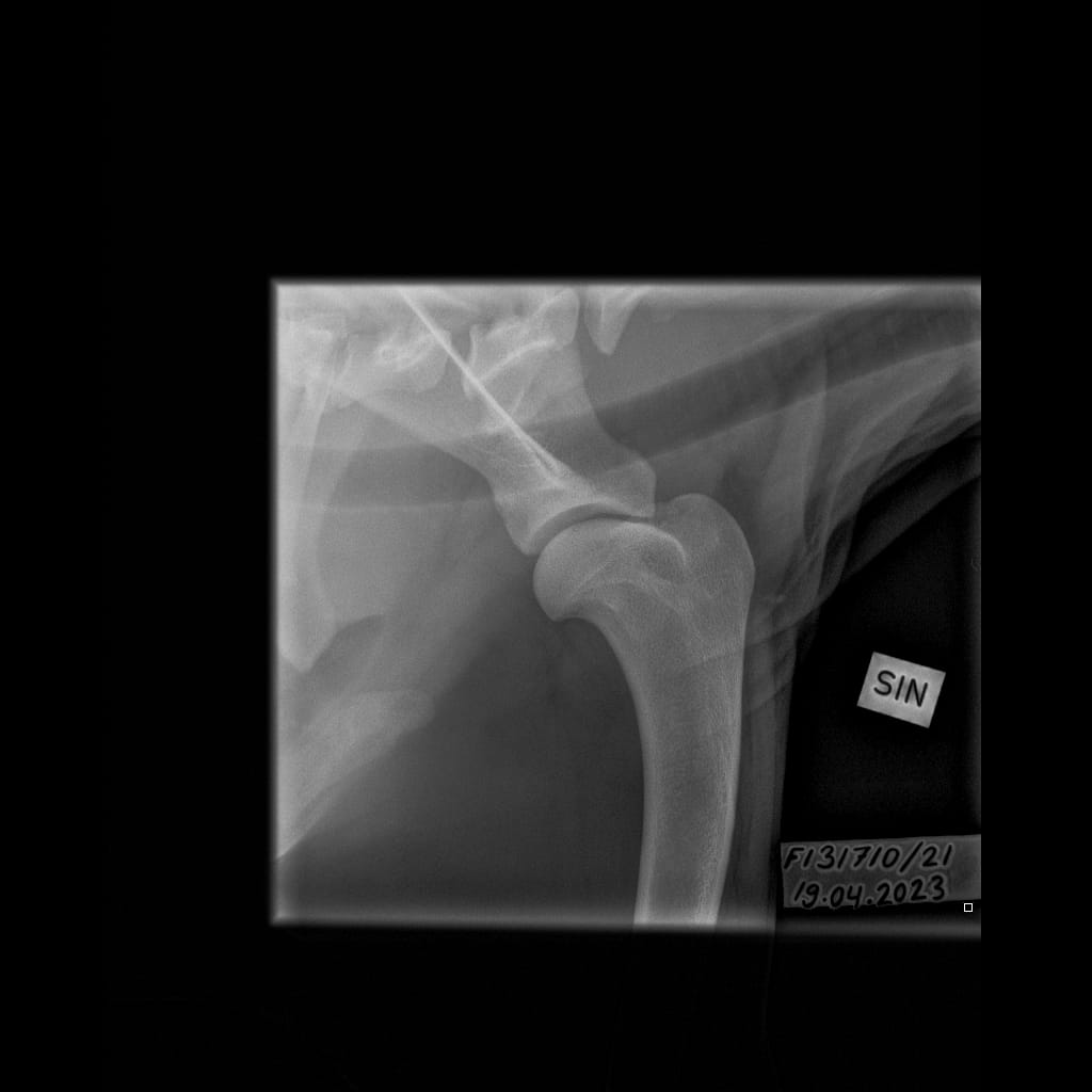 Eturaajat -Olkanivel ML -6.11.2023-16_02_18-265