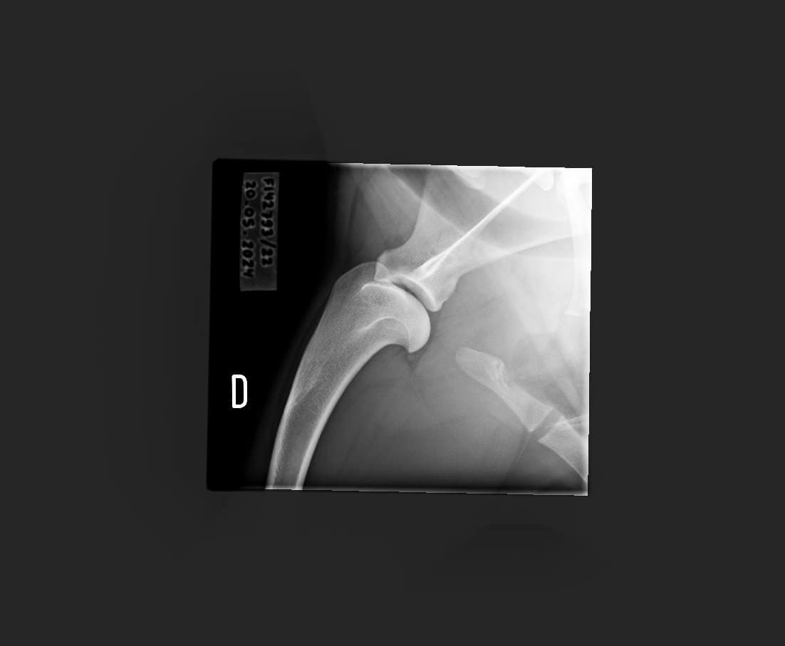 1.2.392.200036.9107.500.220.28487.20240520.142538.9265.1